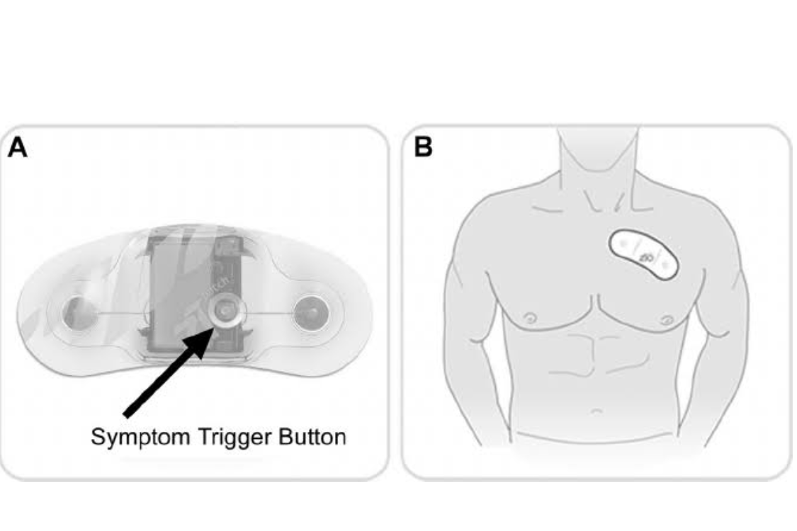 Notre avis sur Zio XT