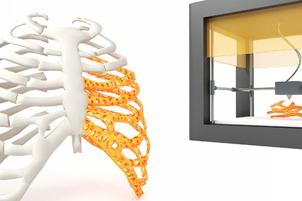 Des modélisations 3D pré-chirurgie, désormais remboursées par une mutuelle