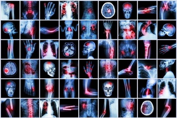 La startup de la semaine : AZmed, l'intelligence artificielle qui repère les fractures pour les radiologues