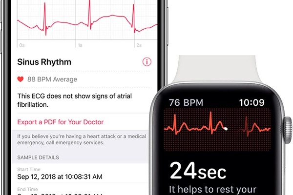 L’électrocardiogramme de l'Apple Watch, gadget ou véritable avancée médicale ?