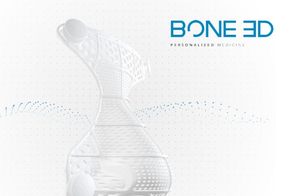 Bone 3D lève 1,4 million d’euros pour ses dispositifs médicaux imprimés en 3D
