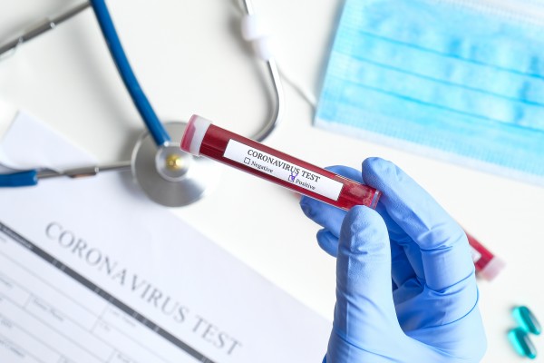 Coronavirus : le Japon a mis au point un kit de dépistage en 10 minutes