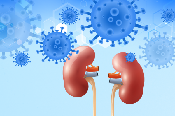 Study : COVID Patients Suffering Acute Kidney Damage