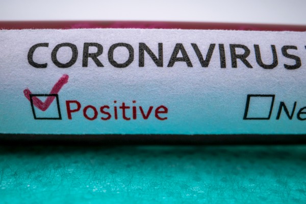 Coronavirus : Un rebond des nouveaux cas de Covid enregistré en Corée du Sud