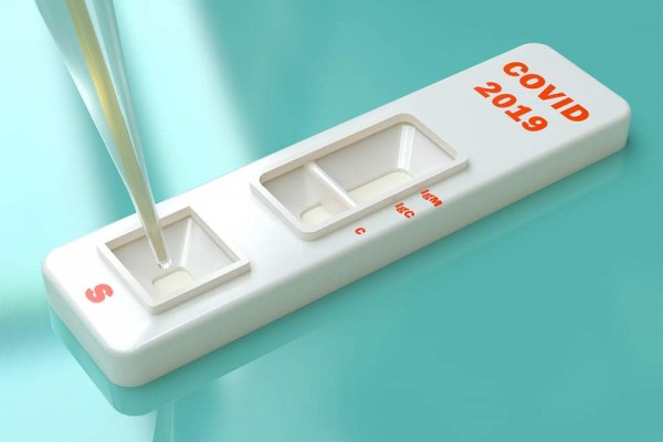 Covid : les tests sérologiques rapides en pharmacie coûtent cher et ne servent à rien