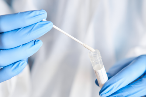 Covid-19 : Évaluation de la performance de plusieurs tests sérologiques de détection d’anticorps