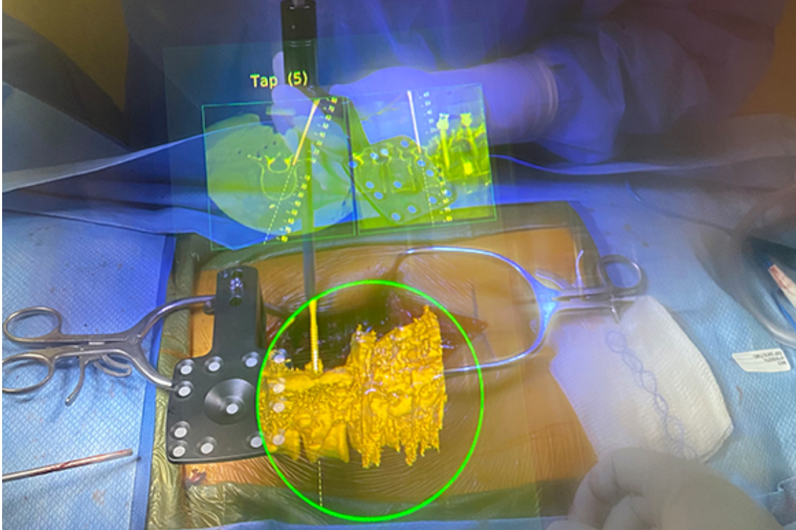Johns Hopkins Performs Its First Augmented Reality Surgeries in Patients
