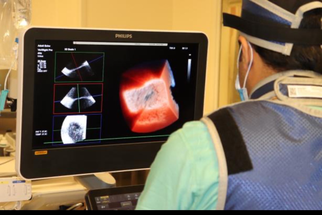 Northwestern Medicine First in U.S. to Use Live 3D Intracardiac Echo for EP Procedure