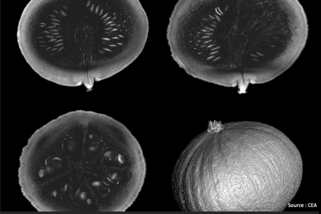 L'IRM le plus puissant du monde dévoile ses premières images d'une précision inégalée