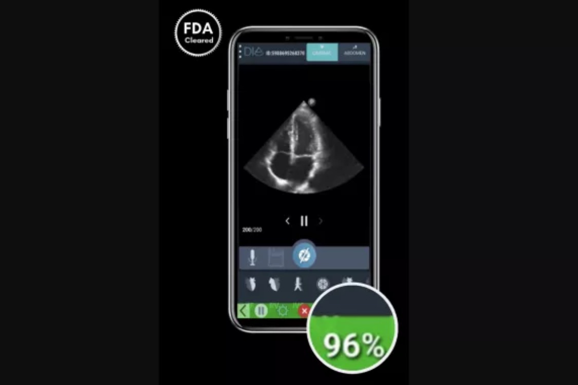 FDA clears new AI-powered cardiac imaging solution