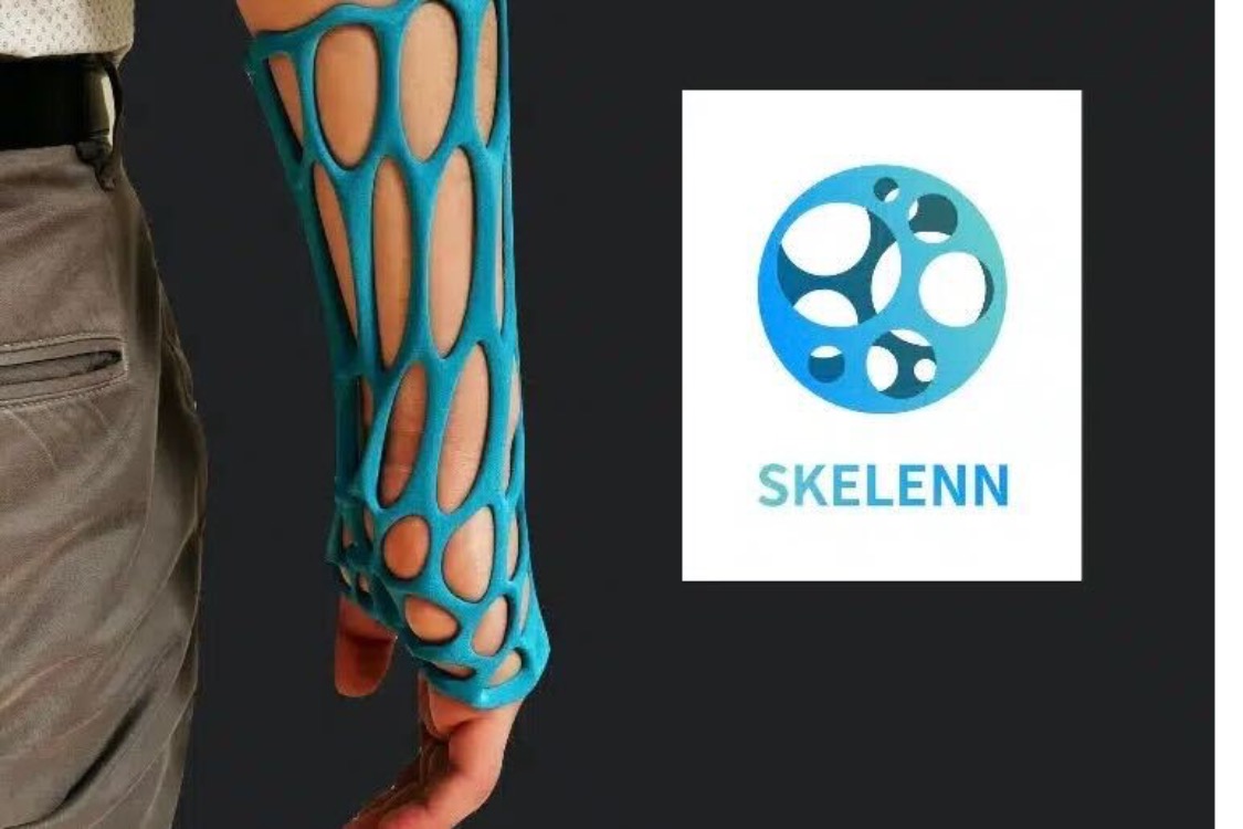Rencontre avec Skelenn : la start-up qui veut mettre fin à l'inconfort des plâtres grâce à l'impression 3D