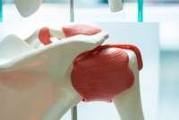 L’impression 3D pour la santé fait des pas de géant