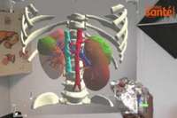 La start-up française Visible Patient aide à traiter le Covid-19 en analysant des images 3D des poumons