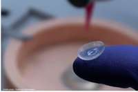 Une cornée imprimée en 3D à partir de cellules humaines