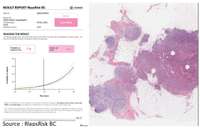 Owkin veut améliorer la prise en charge des cancers du sein et colorectal grâce à l'analyse d'images
