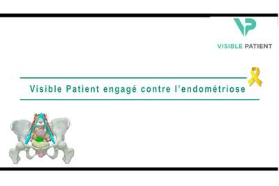 Visible Patient engagé contre l'endométriose