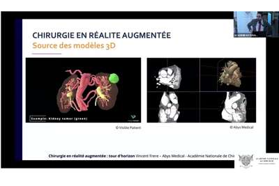 06 Chirurgie en réalité augmenté : tour d'horizon